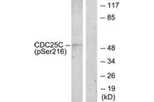 Western blot analysis of extracts from HuvEc cells treated with serum 20% 30', using CDC25C (Phospho-Ser216) Antibody. (CDC25C anticorps  (pSer216))