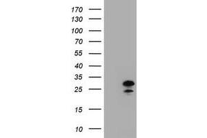 Image no. 2 for anti-Zinc Finger, AN1-Type Domain 5 (ZFAND5) antibody (ABIN1501812) (ZFAND5 anticorps)