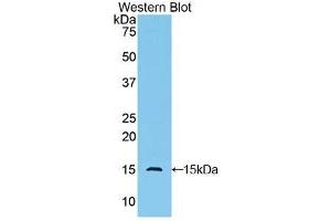 Western blot analysis of the recombinant protein. (GLG1 anticorps  (AA 1048-1145))