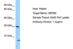 Host: Rabbit Target Name: SNTB2 Sample Type: A549 Whole Cell lysates Antibody Dilution: 1. (SNTB2 anticorps  (N-Term))