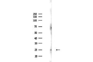 Western blot analysis of lysates from  cells(LPS 4h treatment), using Rab4 Antibody at 1/1000 dilution.