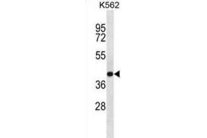 Western Blotting (WB) image for anti-SEC14-Like 4 (SEC14L4) antibody (ABIN2997236) (SEC14L4 anticorps)