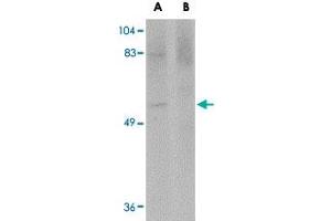 Western blot analysis of MATN4 in rat brain tissue lysate with MATN4 polyclonal antibody  at 1 ug/mL in (A) the absence and (B) the presence of blocking peptide.