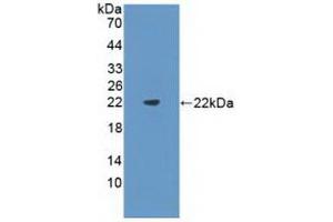 Detection of Recombinant Flt3L, Mouse using Polyclonal Antibody to FMS Like Tyrosine Kinase 3 Ligand (Flt3L) (FLT3LG anticorps  (AA 27-189))