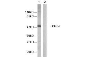 Western blot analysis of extracts from ovary cancer cells using GSK3α (Ab-21) antibody (E021007) (GSK3 alpha anticorps)