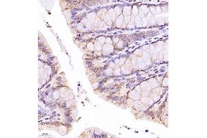 Immunohistochemistry of paraffin embedded rat rectum using SR140 (ABIN7076091) at dilution of 1:1000 (400x lens) (SR140 anticorps)