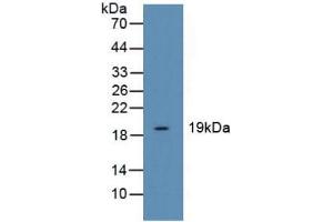 Figure. (Cofilin anticorps  (AA 3-161))