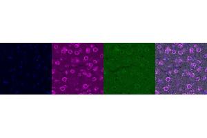 Immunohistochemistry (IHC) image for anti-Interleukin 6 (IL6) antibody (ABIN7456052)