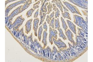 IHC analysis of RNF123 using anti-RNF123 antibody (ABIN6719387).