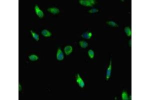 Immunofluorescent analysis of Hela cells using ABIN7155429 at dilution of 1: 100 and Alexa Fluor 488-congugated AffiniPure Goat Anti-Rabbit IgG(H+L)