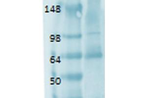 Western Blot analysis of Human thyroid lysate showing detection of Sodium Iodide Symporter protein using Mouse Anti-Sodium Iodide Symporter Monoclonal Antibody, Clone 14F .