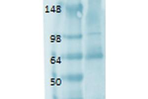 Western Blot analysis of Human thyroid lysate showing detection of Sodium Iodide Symporter protein using Mouse Anti-Sodium Iodide Symporter Monoclonal Antibody, Clone 14F . (SLC5A5 anticorps  (AA 468-643) (Biotin))