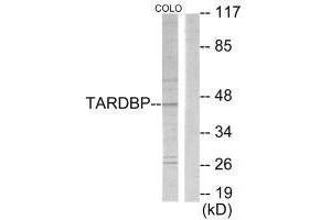 Western blot analysis of extracts from COLO205 cells, using TBX1 antibody. (T-Box 1 anticorps  (C-Term))