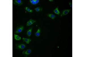 Immunofluorescence staining of A549 cells with ABIN7155085 at 1:266, counter-stained with DAPI. (HHLA2 anticorps  (AA 172-258))
