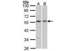 Image no. 1 for anti-Paired Box 6 (PAX6) (AA 1-221) antibody (ABIN467590)
