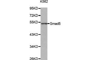Western Blotting (WB) image for anti-SMAD, Mothers Against DPP Homolog 5 (SMAD5) (AA 140-240) antibody (ABIN1682808) (SMAD5 anticorps  (AA 140-240))