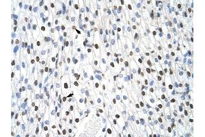 MSI2 antibody was used for immunohistochemistry at a concentration of 4-8 ug/ml to stain Myocardial cells (arrows) in Human Heart. (MSI2 anticorps)