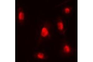 Immunofluorescent analysis of p300 staining in HEK293T cells.