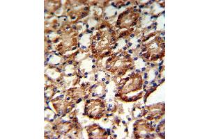 Formalin-fixed and paraffin-embedded kidney tissue reacted with GS Antibody (C-term), which was peroxidase-conjugated to the secondary antibody, followed by DAB staining. (GMP Synthase anticorps  (C-Term))