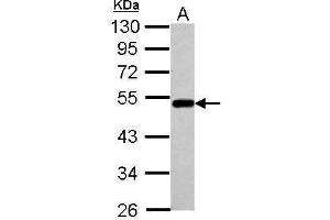 WB Image Sample (30 ug of whole cell lysate) A: A549 10% SDS PAGE antibody diluted at 1:1000 (BLMH anticorps)