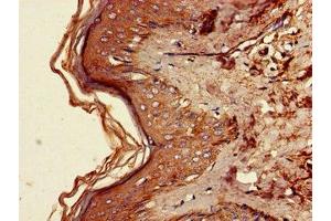 Immunohistochemistry of paraffin-embedded human skin tissue using ABIN7167757 at dilution of 1:100