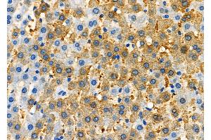 ABIN6263514 and ABIN6277335 at 1/100 staining Rat liver tissue by IHC-P.