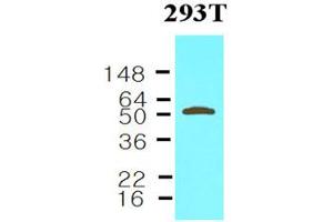 Western blot analysis: Cell lysates of 293T (30ug) were resolved by SDS-PAGE, transferred to NC membrane and probed with anti-human Visfatin (1:1000). (NAMPT anticorps)