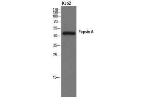 Western Blotting (WB) image for anti-Pepsin A (Internal Region) antibody (ABIN3186390)