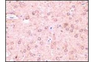 AP20054PU-N Beclin-1 antibody staining of Rat brain tissue by Immunohistochemistry at 2 μg/ml.
