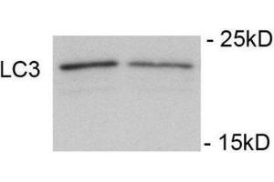 Western Blotting (WB) image for anti-Microtubule-Associated Protein 1 Light Chain 3 gamma (MAP1LC3C) (pSer12) antibody (ABIN2970987) (LC3C anticorps  (pSer12))