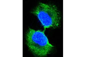Immunocytochemistry (ICC) image for anti-Glutathione S-Transferase pi 1 (GSTP1) antibody (ABIN2983291) (GSTP1 anticorps)