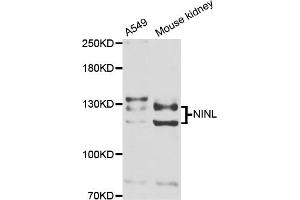 Western blot analysis of extracts of various cell lines, using NINL antibody (ABIN5974637) at 1/1000 dilution. (NINL anticorps)