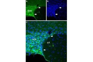 Expression of NALCN in rat hypothalamus - Immunohistochemical staining of rat hypothalamus using Anti-NALCN/VGCNL1 (extracellular) Antibody (ABIN7043658 and ABIN7045249). (NALCN anticorps  (Domain 3, Extracellular))