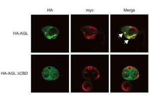 Expression of myc-GS causes wild type but not the ACBD mutant of AGL to aggregate around the S-stain-positive inclusions.