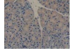 Figure. (REG3B anticorps  (AA 27-175))