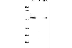 Lane 1: mouse embryo lysates Lane 2: mouse brain lysates probed with Anti Phospho-IRF7 (Ser471/472) Polyclonal Antibody, Unconjugated (ABIN742703) at 1:200 in 4 °C.