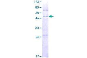 Image no. 1 for Dehydrogenase/reductase (SDR Family) Member 4 Like 2 (DHRS4L2) (AA 1-230) protein (GST tag) (ABIN1351560)