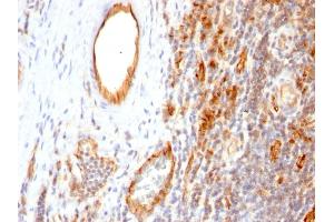 Formalin-fixed, paraffin-embedded human Tonsil stained with CD31 Monoclonal Antibody (1A10)