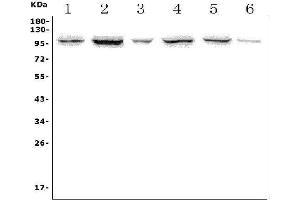 Western blot analysis of PTPN22 using anti-PTPN22 antibody (ABIN7600585).