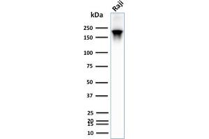Western Blot Analysis of human Raji cell lysate using CD45RB Rabbit Recombinant Monoclonal Antibody (PTPRC/2877R).
