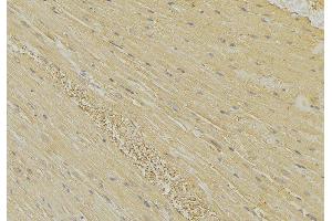 ABIN6274153 at 1/100 staining Mouse muscle tissue by IHC-P. (HEXB anticorps  (C-Term))