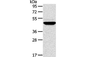 Western blot analysis of Human fetal brain tissue, using TM7SF2 Polyclonal Antibody at dilution of 1:500 (TM7SF2 anticorps)