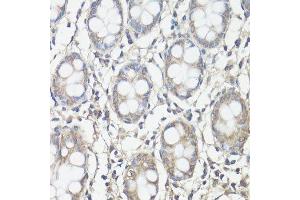 Immunohistochemistry of paraffin-embedded human colon using PTK2 antibody.