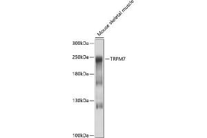 Western blot analysis of extracts of mouse skeletal muscle, using TRPM7 antibody (ABIN6127694, ABIN6149588, ABIN6149589 and ABIN6214200) at 1:1000 dilution.