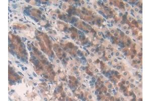 Detection of MMP10 in Rat Stomach Tissue using Polyclonal Antibody to Matrix Metalloproteinase 10 (MMP10)