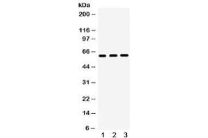 Western blot testing of 1) rat liver, 2) rat kidney, 3) human SW620 lysate with HNF1 beta antibody.