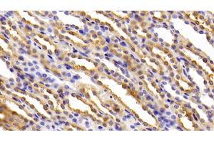 Detection of FTH in Rat Kidney Tissue using Polyclonal Antibody to Ferritin, Heavy Polypeptide (FTH)