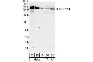 anti-Nucleoporin 214kDa (NUP214) (C-Term) antibody