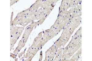 Immunohistochemistry of paraffin-embedded Mouse heart using ACSS2 Polyclonal Antibody at dilution of 1:100 (40x lens). (ACSS2 anticorps)