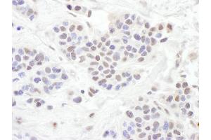Immunohistochemistry (IHC) image for anti-Transducin-Like Enhancer of Split 1 (E(sp1) Homolog, Drosophila) (TLE1) (AA 175-225) antibody (ABIN7454928)